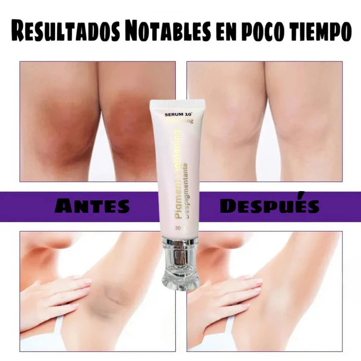 Sérum 10 Despigmenta y aclara la piel